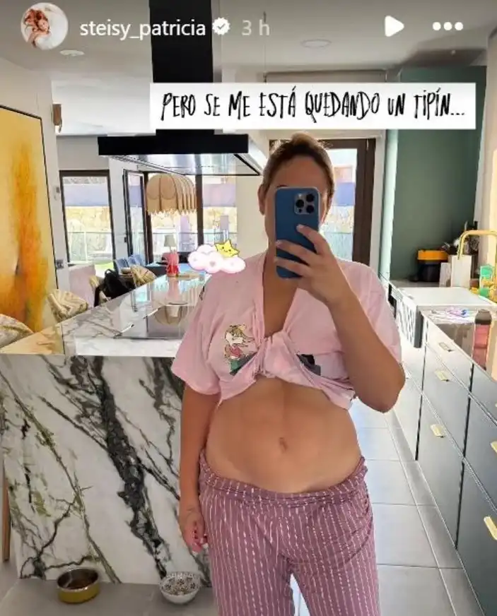 Cambio físico Steisy